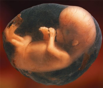 fetus in sac
