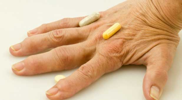 arthritic fingers