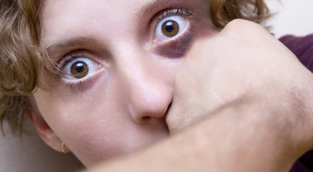 woman getting a black eye